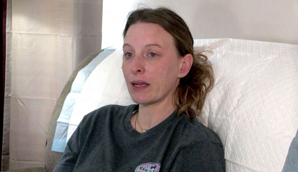 Escaped pet monkey shot after it ripped a woman’s ear in half