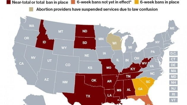 Map: How abortion access has shifted in 11 months since Roe v. Wade was overturned