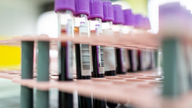 US halts funding access to Wuhan lab at heart of COVID-19 origins debate