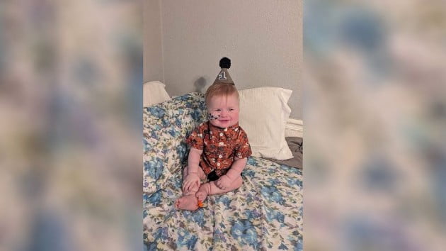 Toddler undergoes first-of-its-kind heart transplant after two open-heart surgeries