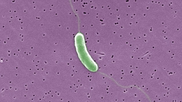 6 die from ‘flesh-eating’ bacteria in 3 East Coast states. Here’s what to know about Vibrio vulnificus