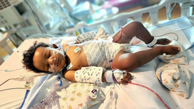 Nurse saves young boy’s life by donating part of her liver