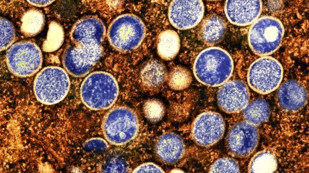 Mpox cases nearly double what they were at the same time last year