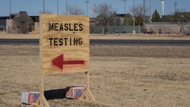 Measles cases in US over 4.5 times higher than all of last year